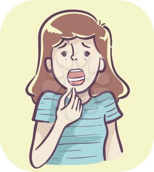 Illustration of a Girl Showing Mouth Ulcers