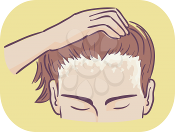 Illustration of a Man Showing Scaly Patches of Scalp