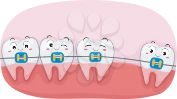 Illustration of Teeth Mascots with Big Space in Between Wearing Braces
