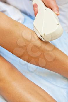 Laser hair removal on ladies legs