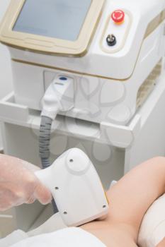 Laser epilation of armpits, hair removal cosmetology procedure. Health and beauty concept.