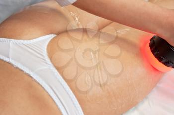 procedure for women buttocks for cellulite and fat