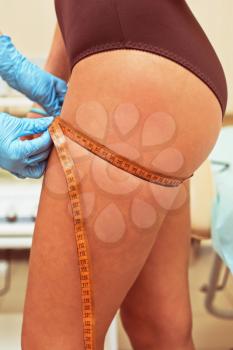 woman before procedures, doctor measuring her hip