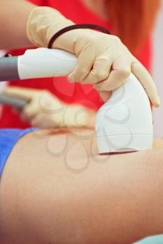 man receiving laser epilation at armpit on beauty center