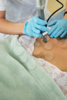 fractional laser rejuvenation of neckline area for women