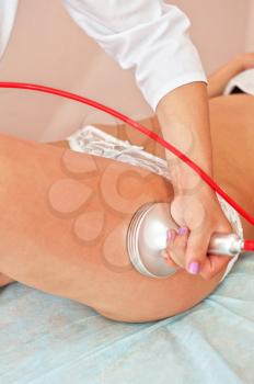 procedure for women hip for cellulite and fat