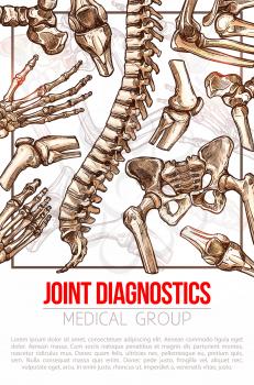 Joints diagnostics medical poster for hospital. Vector design of human body bones spine or knee and arm or hand fingers and leg for health therapy or x-ray examination, orthopedic or medical surgery