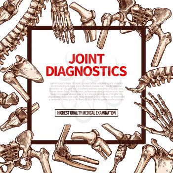 Joints diagnostics or human body medical examination poster. Vector joint bones of spine, leg or foot ankle and hand or arm wrist for health therapy or x-ray orthopedic and surgery hospital design