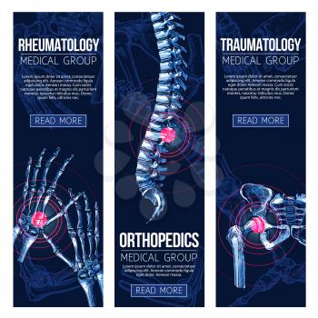 Rheumatology and orthopedics traumatology medicine banners. Vector set of medical x-ray of human body bones and joints for leg knee or foot, spine and arm hand trauma, and wrist arthritis