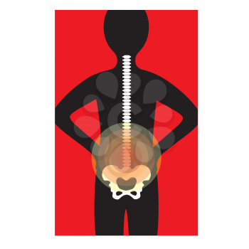 Silhouette of a human back with the spine - rays of pain are shown on the lower back