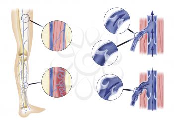 Royalty Free Clipart Image of a Diagram of a Leg Artery and Valves