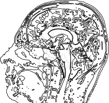 Topographic map MRI of the human brain. Vector illustration