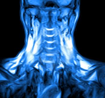 Magnetic resonance imaging of the cervical spine. MRI vertebral discs vector illustration