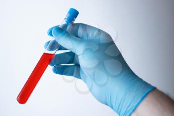 A doctor in blue disposable latex gloves is holding a test tube with a blood sample.
