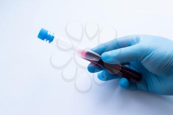 A doctor in blue disposable latex gloves is holding a test tube with a blood sample.