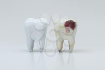 The decayed tooth beside with the white tooth, 3d rendering. Computer digital drawing.