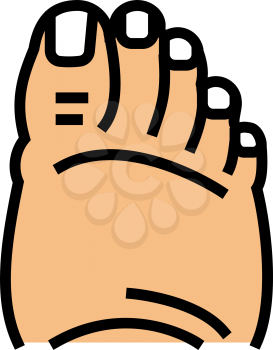 fatty foot edema color icon vector. fatty foot edema sign. isolated symbol illustration