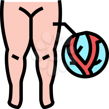 lymphatic edema color icon vector. lymphatic edema sign. isolated symbol illustration