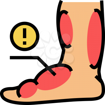 leg edema critical leg health problem color icon vector. leg edema critical leg health problem sign. isolated symbol illustration
