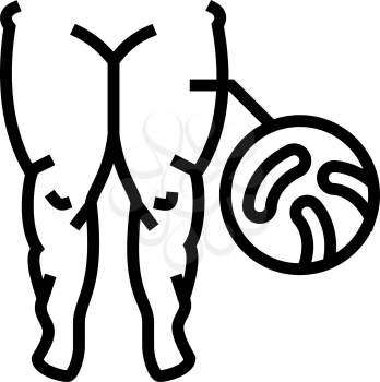 fatty edema line icon vector. fatty edema sign. isolated contour symbol black illustration