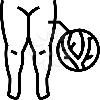 lymphatic edema line icon vector. lymphatic edema sign. isolated contour symbol black illustration