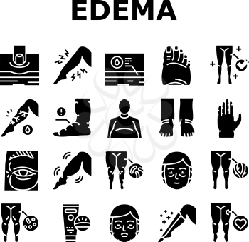 Edema Disease Symptom Collection Icons Set Vector. Venous And Fatty, Lymphatic And Hypoproteinemic, Allergic And Heart Edema Health Problem Glyph Pictograms Black Illustrations