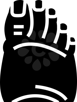 fatty foot edema glyph icon vector. fatty foot edema sign. isolated contour symbol black illustration