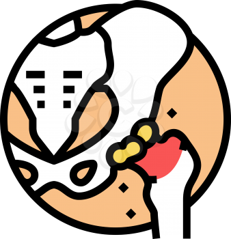 articular cartilage gout color icon vector. articular cartilage gout sign. isolated symbol illustration