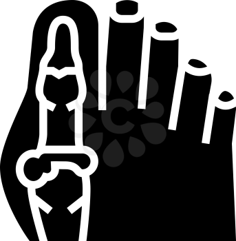 foot big toe bone gout glyph icon vector. foot big toe bone gout sign. isolated contour symbol black illustration