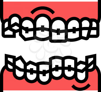 correction tooth braces color icon vector. correction tooth braces sign. isolated symbol illustration