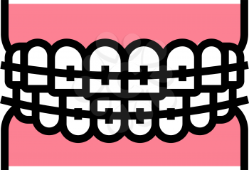 tooth braces color icon vector. tooth braces sign. isolated symbol illustration