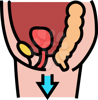 organ prolapse disease color icon vector. organ prolapse disease sign. isolated symbol illustration