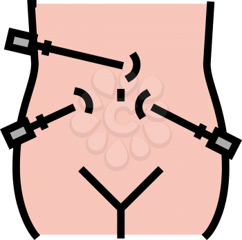 laparoscopy bariatric color icon vector. laparoscopy bariatric sign. isolated symbol illustration