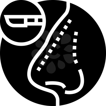 rhinoplasty treatment line icon vector. rhinoplasty treatment sign. isolated contour symbol black illustration