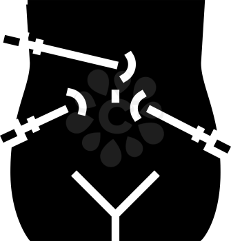 laparoscopy bariatric line icon vector. laparoscopy bariatric sign. isolated contour symbol black illustration