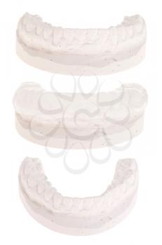 Royalty Free Photo of Gum Model Casts