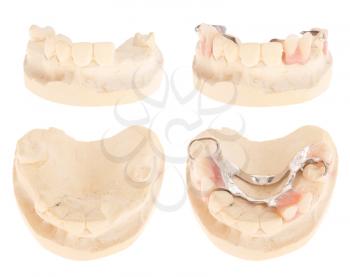 Royalty Free Photo of Cast Models With Missing Teeth 