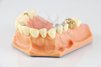 Royalty Free Photo of a Dental Model