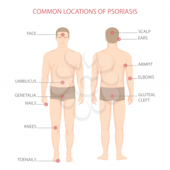 psoriasis illness diagram, human body skin disease,