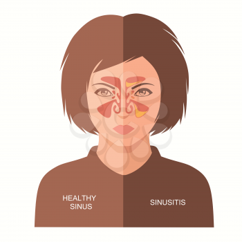 sinusitis disease, vector nose illustration, sinus anatomy, human respiratory system
