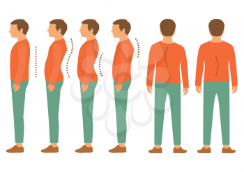 scoliosis, lordosis spine disease, back body posture defect