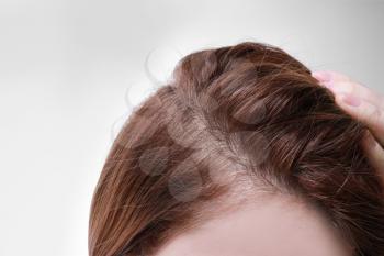 Woman with hair loss problem on white background, closeup�