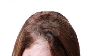 Woman with hair loss problem on white background, closeup�