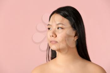 Portrait of young Asian woman with acne problem on color background�