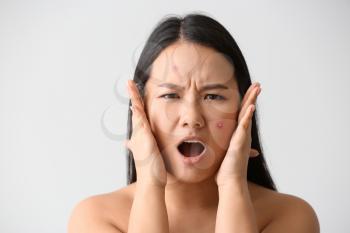 Portrait of stressed Asian woman with acne problem on white background�