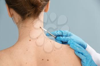 Doctor with lancet going to remove mole from patient's skin�