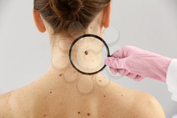 Dermatologist examining moles of patient on light background�