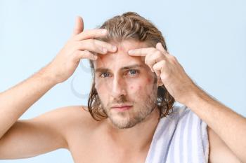 Portrait of young man with acne problem squishing pimples on color background�