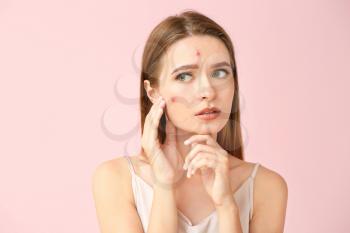 Portrait of young woman with acne problem on color background�