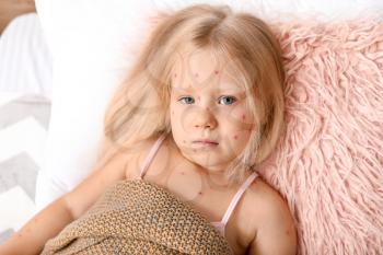 Little girl ill with chickenpox lying in bed�
